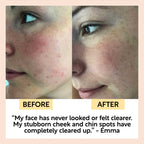 Chai Soap Cleansing Duo