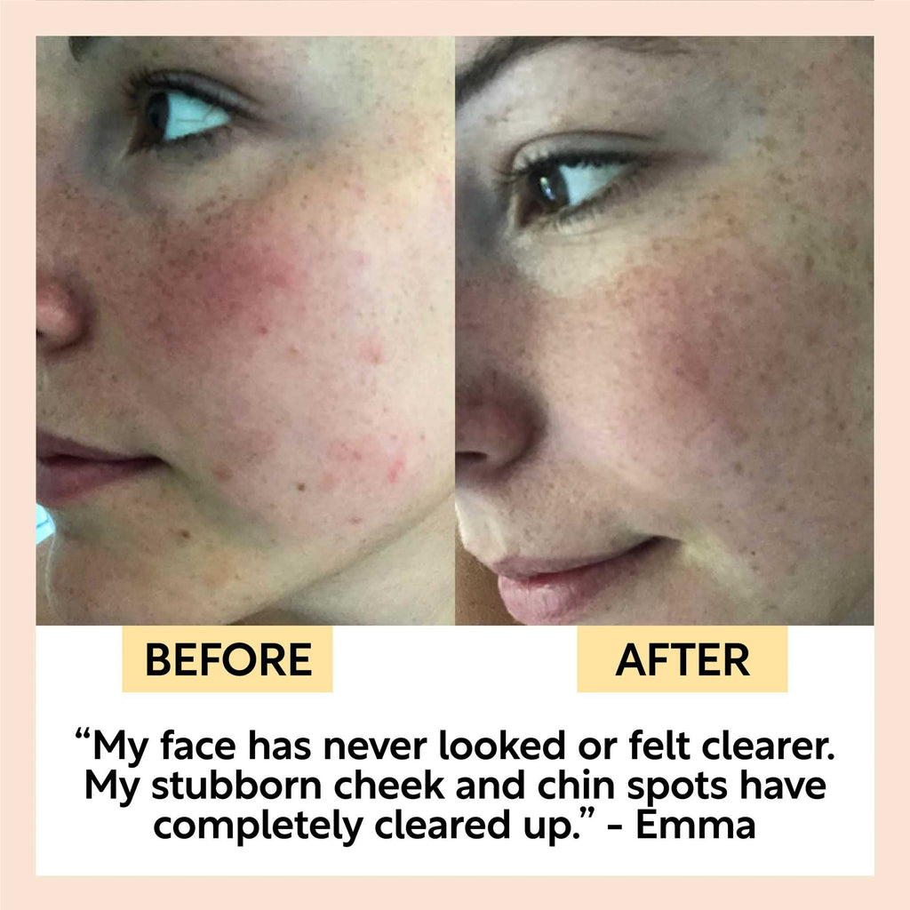 Cinnamon + Ginger Cleansing Bar