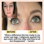 Eye Cream with Hyaluronic Acid & Coffee