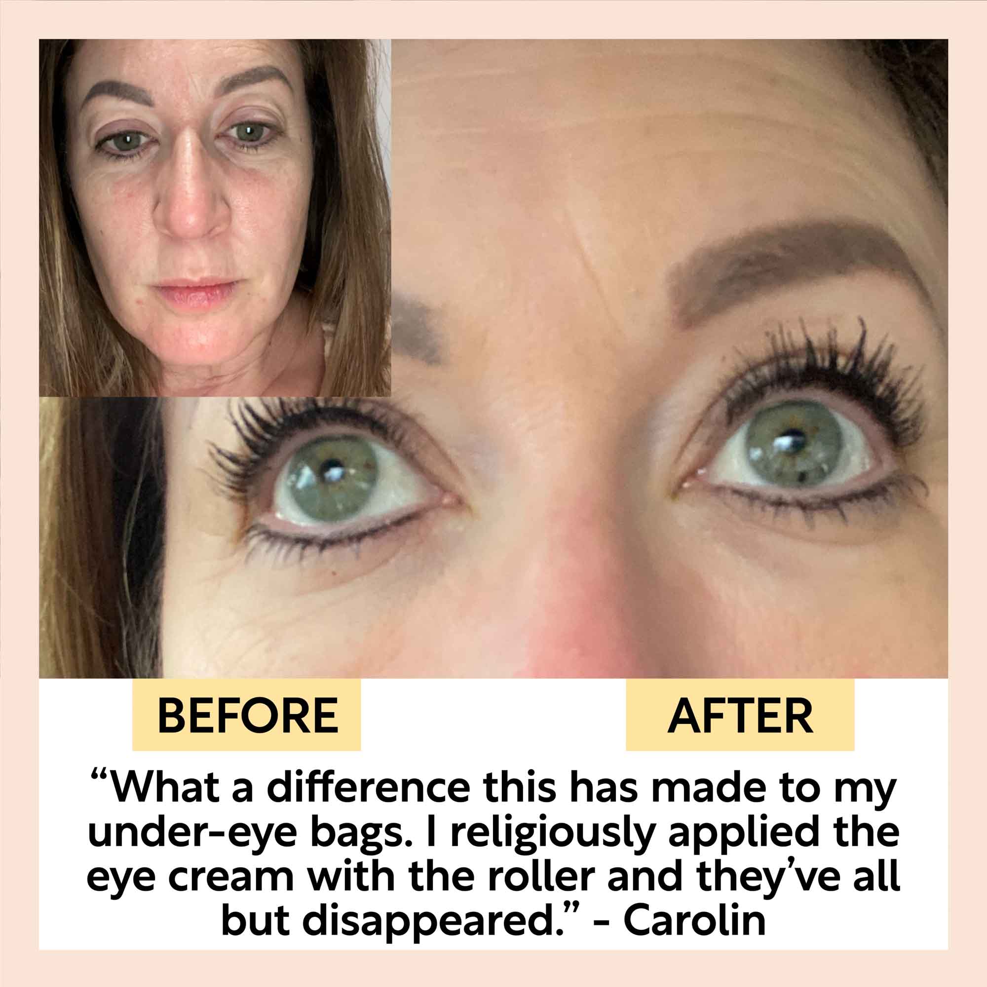 The Caffeinated Duo + Eye Roller Deal