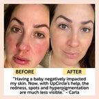 Day + Night Hydration Set