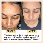 Face Toner with Hyaluronic Acid