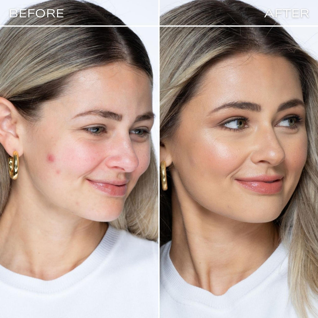 Redness Rescue Corrective Palette