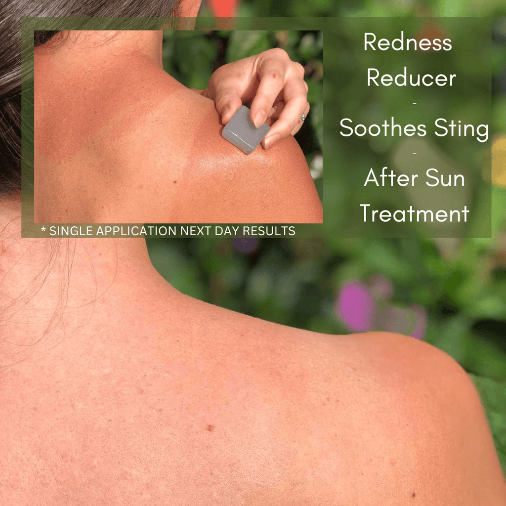 Person applying product on their shoulder with greenery in the background