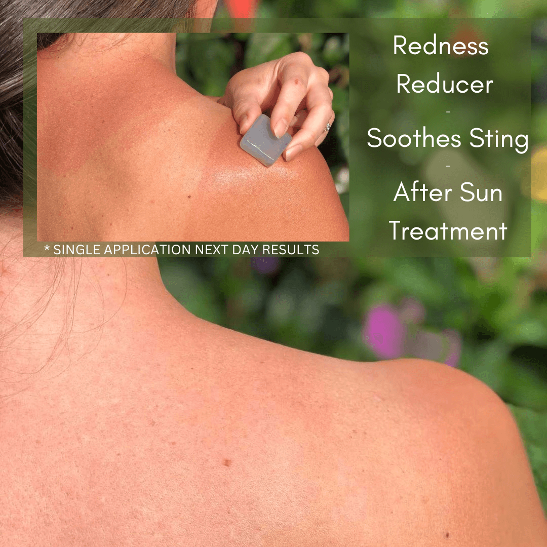 Person applying product on their shoulder with greenery in the background